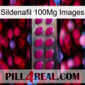 Sildenafil 100Mg Images 09